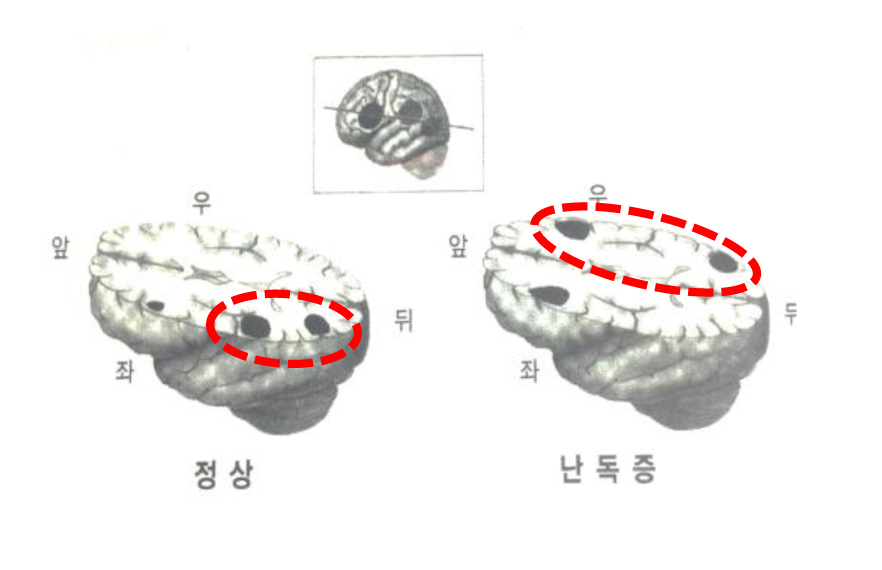 좌뇌_언어회로.jpg